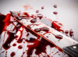 Gruesome Murder of Transgender Woman Will Leave You Sick to Your Stomach A bloody knife.